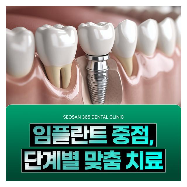 임플란트 중점, 단계별 맞춤 치료로 꼼꼼하고 편안하게
