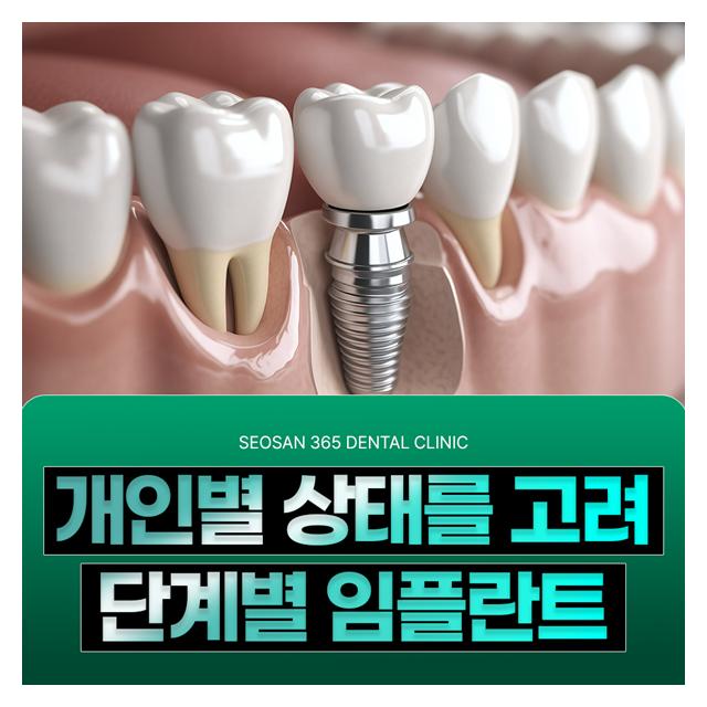 개인별 상태를 고려한 단계별 임플란트 진료
